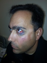 James Marrs after an assault
