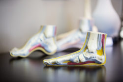 Physician models of feet help people with diabetes understand the impact of the disease on blood flow to their lower limbs. (Megan Wood, inewsource)